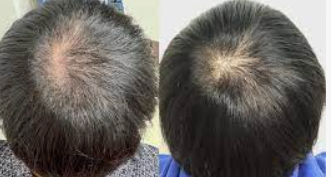 AGAスキンクリック 評判時になる料金 薬は郵送される?